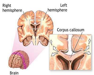 Cuerpo Calloso y Hemisferios Cerebrales